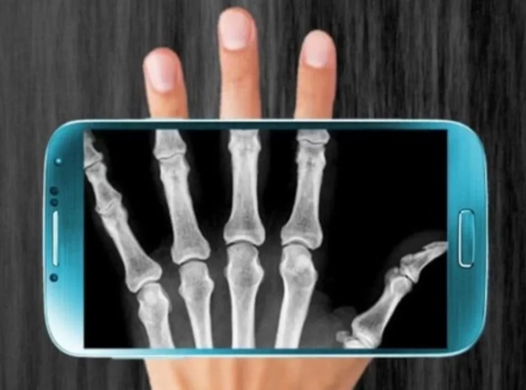Free X RAY Apps Zukmob