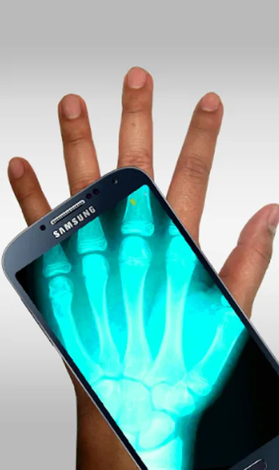 Aplicativos Gratuitos De Raio X Zukmob